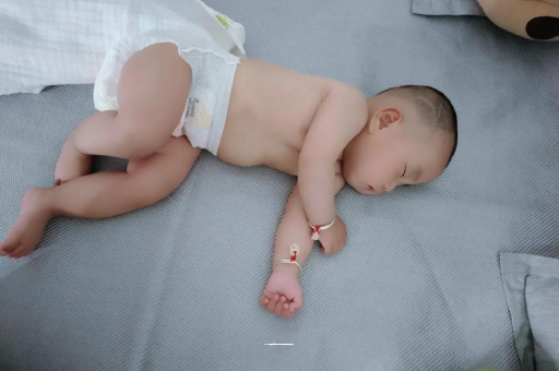 安顺宝宝头上长痱子 安顺宝宝头上长痱子